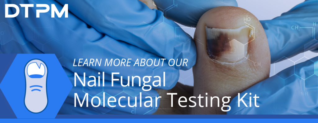 DTPM Nail Fungal Kit Blog Post Header Featured Img