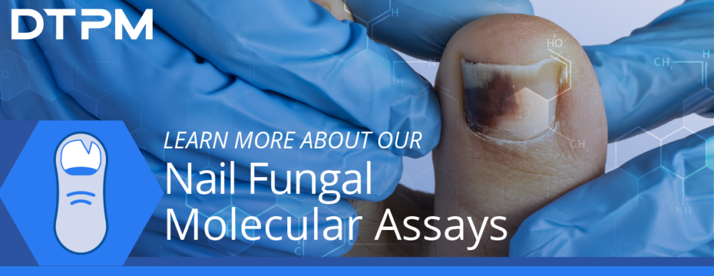 Nail fungal molecular assays developed by DTPM